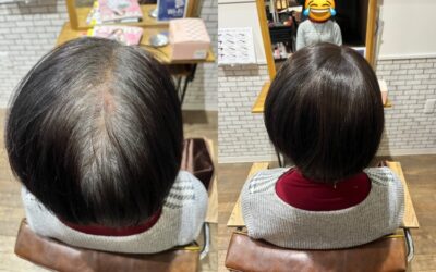 ウイッグが初めての方にこそ、知ってほしい。